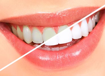 Estetică dentară